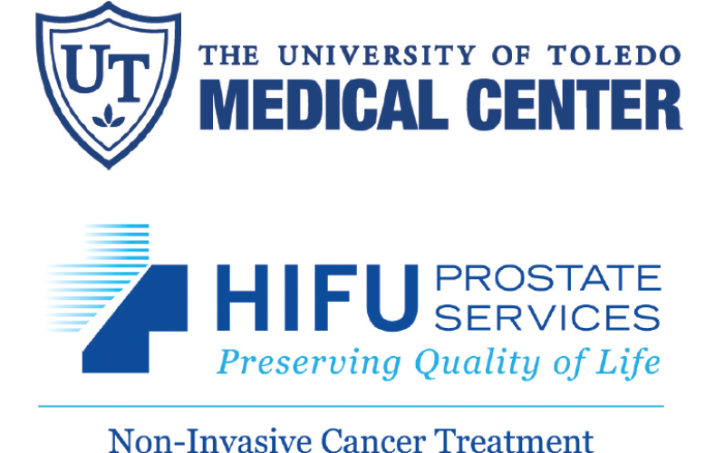 UTMC HIFU