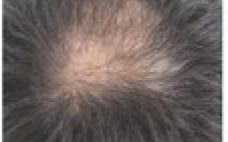 Alt Text for Image