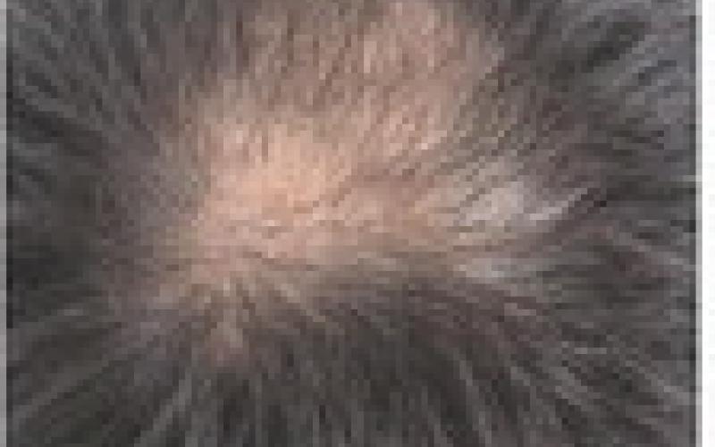 Alt Text for Image