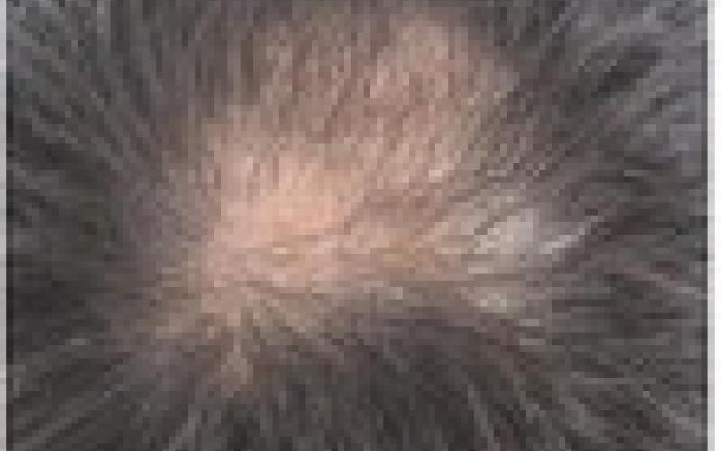 Alt Text for Image