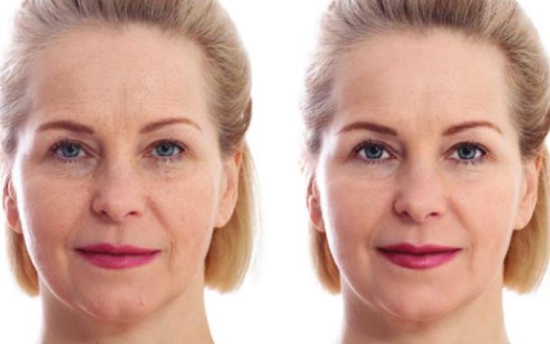 Time to look as young as you feel!