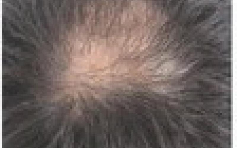 Alt Text for Image