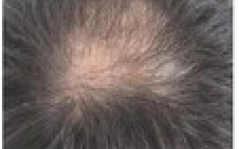 Alt Text for Image