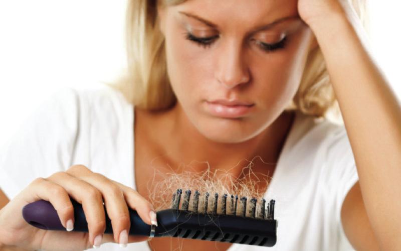 Hair loss women