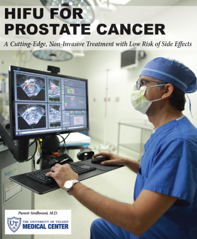 HIFU for prostate cancer