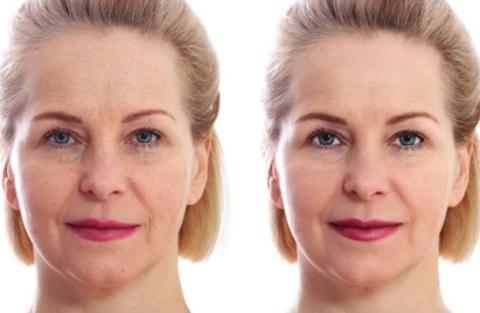 Time to look as young as you feel!